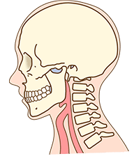 頸椎捻挫型