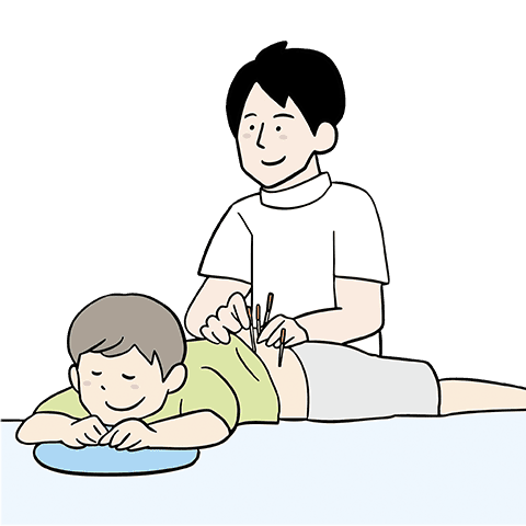 鍼、美容鍼イメージ画像